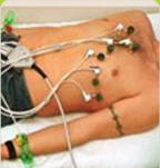 Electrocardiograma ECG/EKG